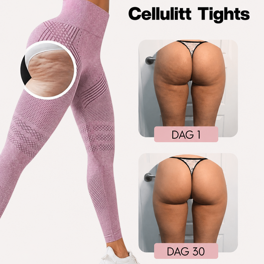Flexitrener™ 3D Sculpt Anti-cellulite-leggings