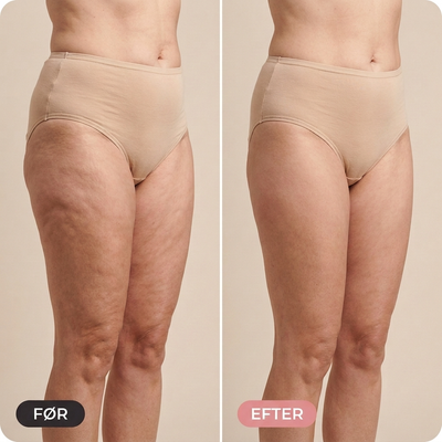 Flexitrener™ CoreShaper